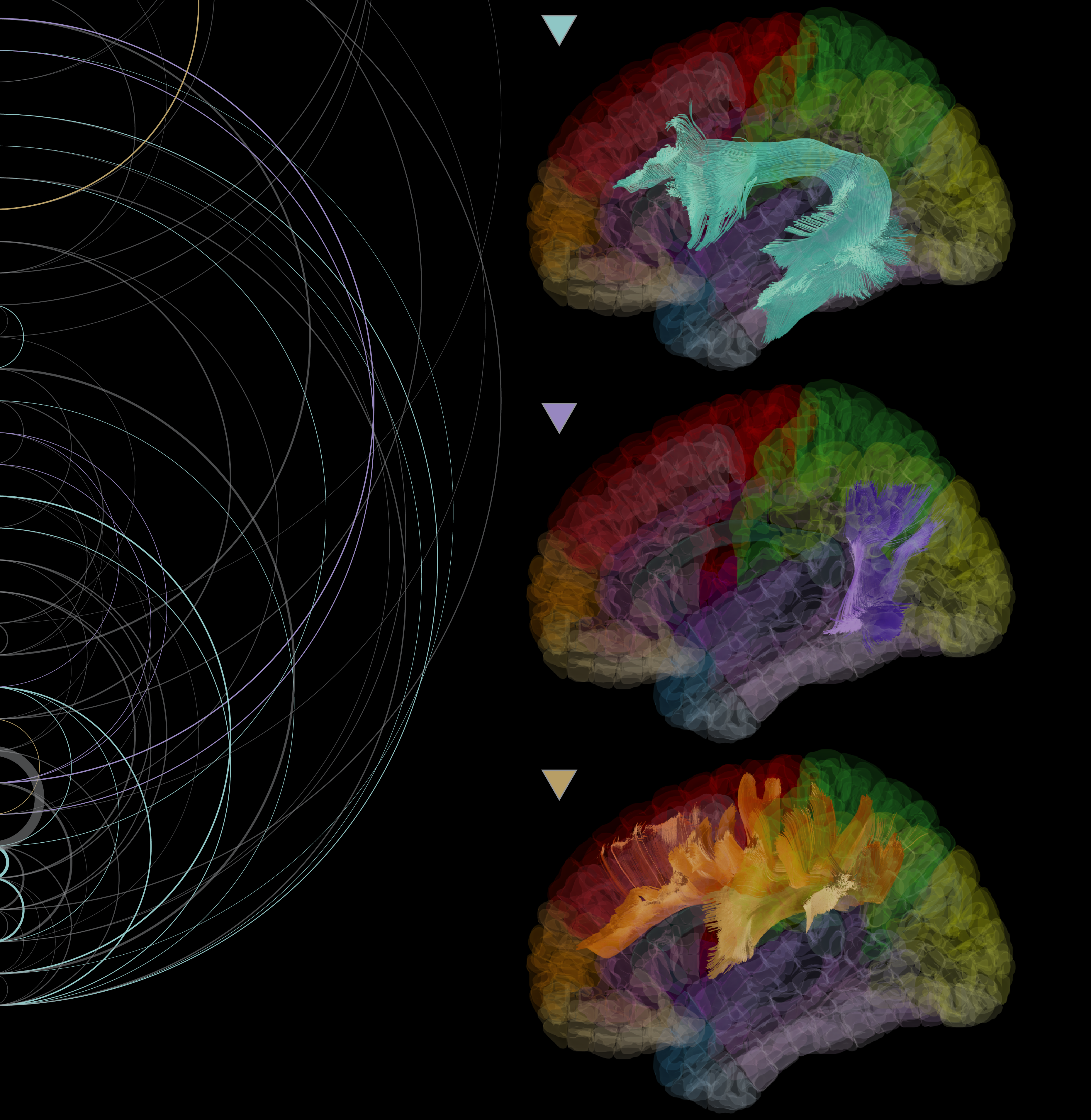 3D glass brain models with white matter tracts